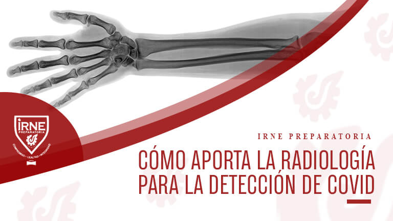 Radiología para la detección de covid